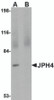 Western blot analysis of JPH4 in 293 cell lysate with JPH4 antibody at 1 &#956;g/mL in (A) the absence and (B) the presence of blocking peptide.
