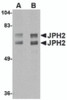 Western blot analysis of JPH2 in mouse brain tissue lysate with JPH2 antibody at (A) 1 and (B) 2 &#956;g/mL.