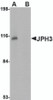 Western blot analysis of JPH3 in Daudi cell lysate with JPH3 antibody at 1 &#956;g/mL in (A) the absence and (B) the presence of blocking peptide.