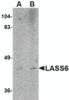 Western blot analysis of LASS6 in rat brain tissue lysate with LASS6 antibody at (A) 1 and (B) 2 &#956;g/mL.
