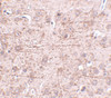 Immunohistochemistry of ZBTB1 in mouse brain tissue with ZBTB1 antibody at 2.5 ug/mL.