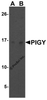 Western blot analysis of PIG-Y in human liver tissue lysate with PIG-Y antibody at (A) 1 and (B) 2 &#956;g/mL.