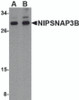 Western blot analysis of NIPSNAP3B in mouse brain tissue lysate with NIPSNAP3B antibody at (A) 1 and (B) 2 &#956;g/mL.