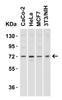 Figure 2 Western Blot Validation in Human and Mouse Cell Lines
Loading: 15 ug of lysates per lane.
Antibodies: TOM70 4959 (2 ug/mL) , 1h incubation at RT in 5% NFDM/TBST.
Secondary: Goat anti-rabbit IgG HRP conjugate at 1:10000 dilution.