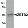 Western blot analysis of ZBTB2 in PC-3 cell lysate with ZBTB2 antibody at 1 &#956;g/mL.