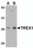 Western blot analysis of TREX1 in human spleen tissue lysate with TREX1 antibody at (A) 0.5 and (B) 1 &#956;g/mL.