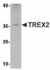 Western blot analysis of TREX2 in rat liver tissue lysate with TREX2 antibody at 2.5 &#956;g/mL.