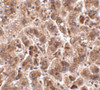 Immunohistochemistry of TREX2 in human liver tissue with TREX2 antibody at 2.5 ug/mL.