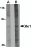 Western blot analysis of Gle1 in 293 cell lysate with Gle1 antibody at (A) 1 and (B) 2 &#956;g/mL.