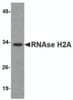 Western blot analysis of RNAse H2A in HeLa cell lysate with RNAse H2A antibody at 1 &#956;g/mL.