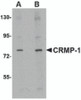 Western blot analysis of CRMP1 in rat brain tissue lysate with CRMP1 antibody at (A) 1 and (B) 2 &#956;g/mL.