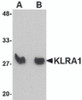Western blot analysis of KLRA1 in mouse spleen tissue lysate with KLRA1 antibody at (A) 1 &#956;g/mL and (B) 2 &#956;g/mL.