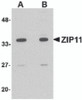 Western blot analysis of ZIP11 in mouse kidney tissue lysate with ZIP11 antibody at (A) 1 and (B) 2 &#956;g/mL.