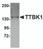 Western blot analysis of TTBK1 in Jurkat lysate with TTBK1 antibody at 1 &#956;g/mL.