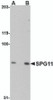 Western blot analysis of SPG11 in mouse heart tissue lysate with SPG11 antibody at (A) 0.5 and (B) 1 &#956;g/mL.