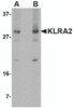 Western blot analysis of KLRA2 in mouse spleen tissue lysate with KLRA2 antibody at (A) 0.5 and (B) 1 &#956;g/mL.
