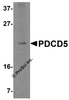 Western blot analysis of PDCD5 in Jurkat cell lysate with PDCD5 antibody at 2.5 &#956;g/mL.