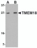 Western blot analysis of TMEM18 in rat brain lysate with TMEM18 antibody at (A) 0.5 and (B) 1 &#956;g/mL.