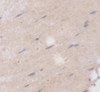 Immunohistochemistry of FNIP2 in mouse skeletal muscle tissue with FNIP2 antibody at 5 ug/mL.