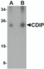 Western blot analysis of CDIP in human brain lysate with CDIP antibody at (A) 0.25 and (B) 0.5 &#956;g/mL.