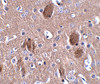 Immunohistochemistry of CDIP in mouse brain tissue with CDIP antibody at 2.5 ug/mL.