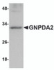 Western blot analysis of GNPDA2 in human kidney lysate with GNPDA2 antibody at 1 &#956;g/mL.