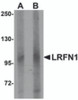 Western blot analysis of LRFN1 in human brain lysate with LRFN1 antibody at (A) 1 and (B) 2 &#956;g/mL.