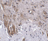 Immunohistochemistry of LRFN1 in mouse brain tissue with LRFN1 antibody at 2.5 ug/mL.