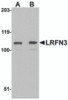 Western blot analysis of LRFN3 in K562 lysate with LRFN3 antibody at (A) 1 and (B) 2 &#956;g/mL.