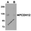 Western blot analysis of PCDH12 in K562 cell lysate with PCDH12 antibody at 1 &#956;g/mL in (A) the absence and (B) the presence of blocking peptide.