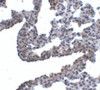 Immunohistochemistry of PCDH12 in rat lung tissue with PCDH12 antibody at 5 ug/mL.