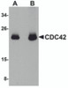 Western blot analysis of CDC42 in human brain tissue lysate with CDC42 antibody at (A) 0.5 and (B) 1 &#956;g/mL.