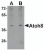 Western blot analysis of ATOH8 in A-20 cell lysate with ATOH8 antibody at (A) 1 and (B) 2 &#956;g/mL.