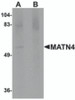 Western blot analysis of MATN4 in rat brain tissue lysate with MATN4 antibody at 1 &#956;g/mL in (A) the absence and (B) the presence of blocking peptide.