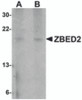 Western blot analysis of ZBED2 in A549 cell lysate with ZBED2 antibody at (A) 1 and (B) 2 &#956;g/mL.