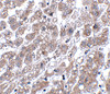 Immunohistochemistry of MATN1 in human liver tissue with MATN1 antibody at 5 ug/mL.