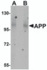 Western blot analysis of APP in mouse brain tissue lysate with APP antibody at (A) 1 and (B) 2 &#956;g/mL.