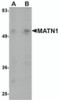Western blot analysis of MATN1 in mouse liver tissue lysate with MATN1 antibody at (A) 1 and (B) 2 &#956;g/mL.