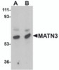 Western blot analysis of MATN3 in rat thymus tissue lysate with MATN3 antibody at (A) 1 and (B) 2 &#956;g/mL.