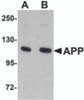 Western blot analysis of APP in rat brain tissue lysate with APP antibody at (A) 1 and (B) 2 &#956;g/mL.