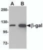 Western blot analysis of (A) 5 and (B) 25 ng of b-gal with b-gal antibody at 1 &#956;g/mL.