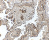 Immunohistochemistry of Transthyretin in human lung tissue with Transthyretin antibody at 2.5 ug/mL.