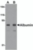 Western blot analysis of Albumin in mouse liver tissue lysate with Albumin antibody at (A) 1 and (B) 2 &#956;g/mL.
