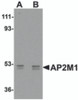 Western blot analysis of AP2M1 in human kidney tissue lysate with AP2M1 antibody at (A) 1 and (B) 2 &#956;g/mL.