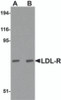 Western blot analysis of LDL-R in human liver tissue lysate with LDL-R antibody at (A) 1 and (B) 2 &#956;g/mL.