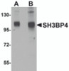 Western blot analysis of SH3BP4 in rat lung tissue lysate with SH3BP4 antibody at (A) 1 and (B) 2 &#956;g/mL.