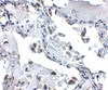 Immunohistochemistry of SH3BP4 in human lung tissue with SH3BP4 antibody at 5 ug/mL.