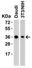 Figure 1 Western Blot Validation in Human and Mouse Cell Lines
Loading: 15 &#956;g of lysates per lane.
Antibodies: RSPO1, 5171 (2 &#956;g/mL) , 1h incubation at RT in 5% NFDM/TBST.
Secondary: Goat anti-rabbit IgG HRP conjugate at 1:10000 dilution.