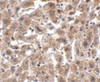 Immunohistochemistry of OCLN in human liver tissue with OCLN antibody at 2.5 ug/mL.