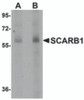 Western blot analysis of SCARB1 in human spleen tissue lysate with SCARB1 antibody at (A) 1 and (B) 2 &#956;g/mL.
